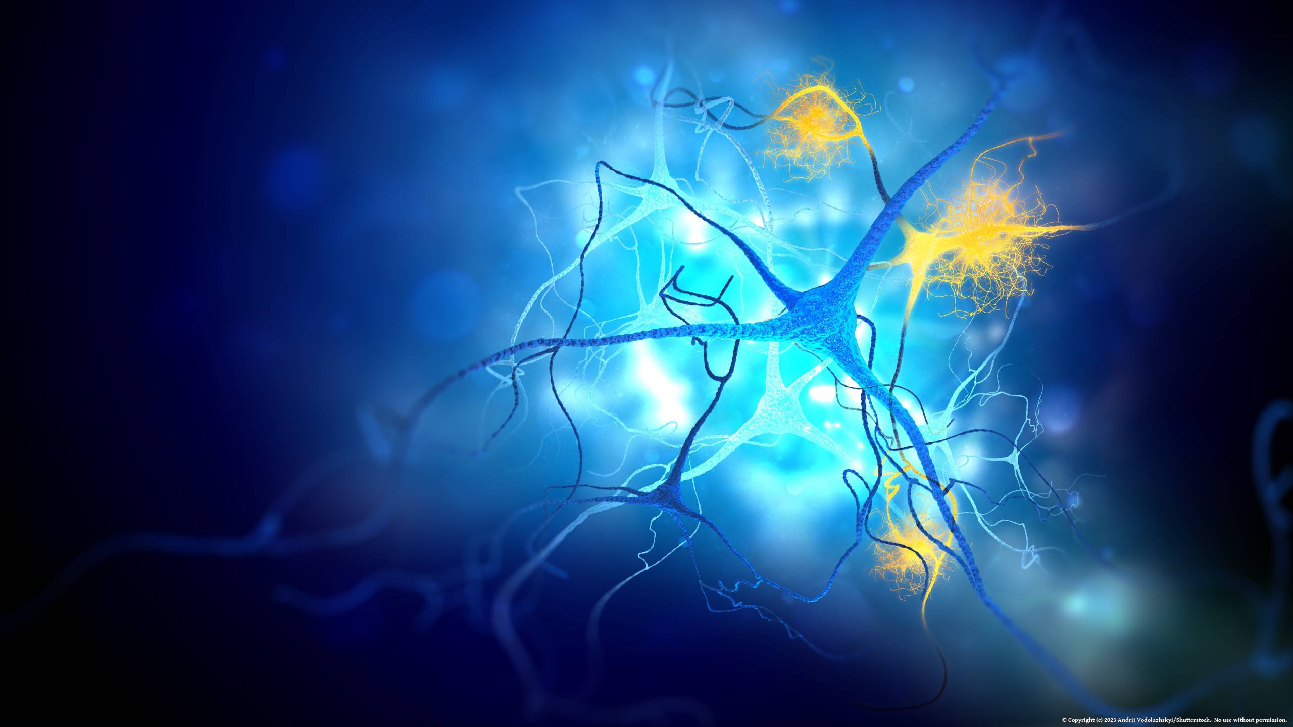 Neurons,Damaged,By,Alzheimer's,Disease,(3d,Illustration)